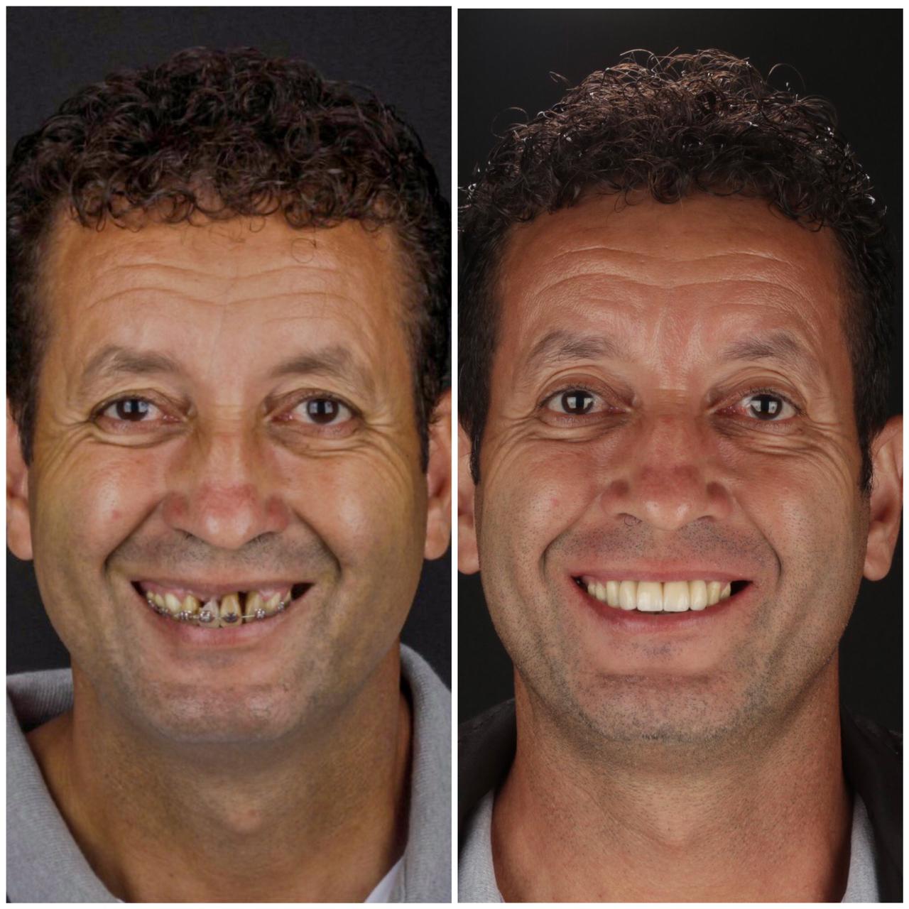 José Antonio Barreto