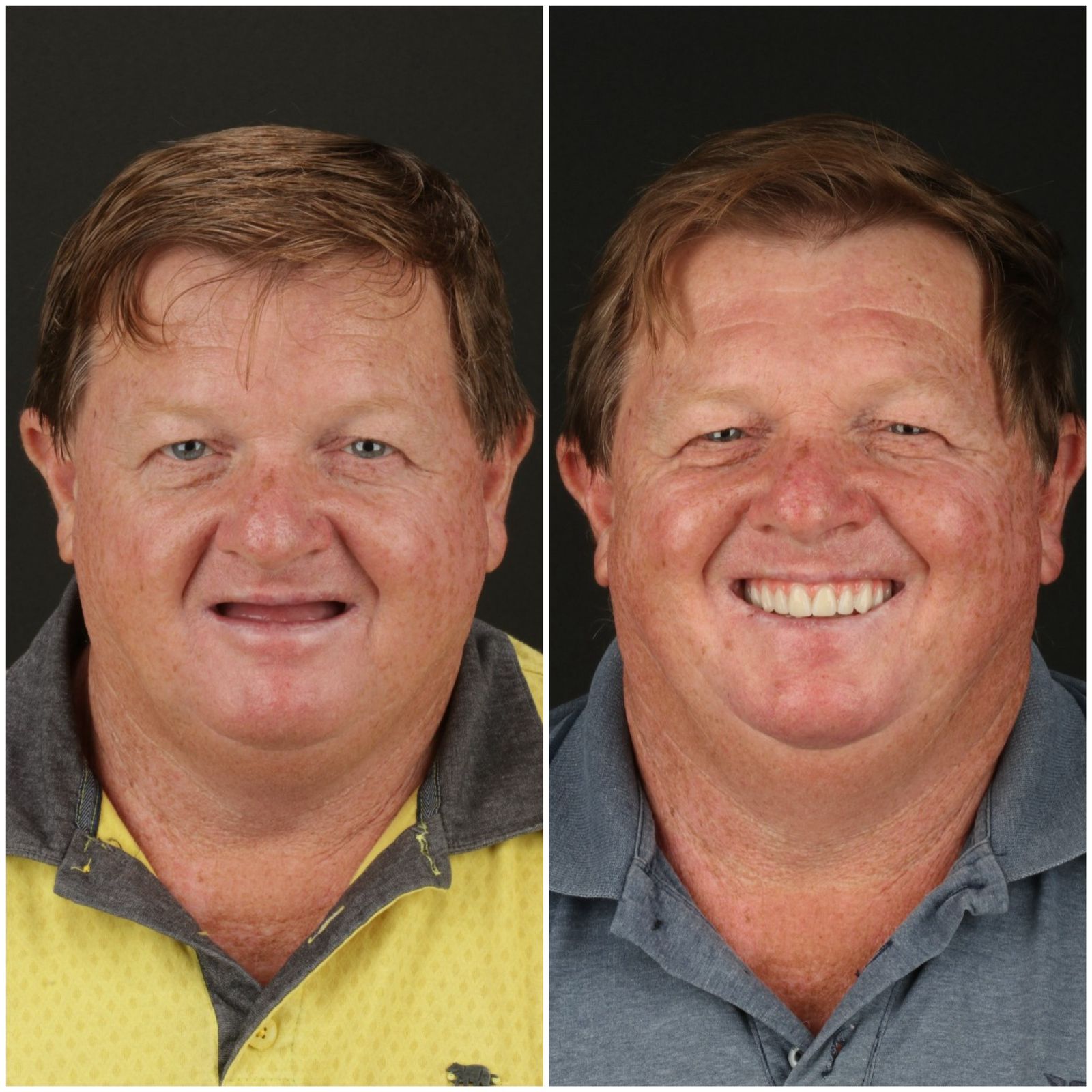 José Aparecido Tabaquini